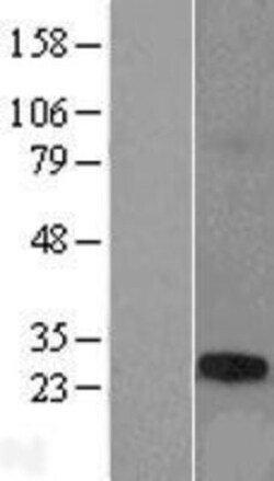Novus Biologicals&trade;&nbsp;TCP10L Overexpression Lysate