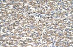 TCP10L Antibody, Novus Biologicals 100&mu;L; Unlabeled:Antibodies, Polyclonal