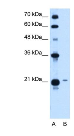 TCP10L Antibody, Novus Biologicals 100&mu;L; Unlabeled:Antibodies, Polyclonal
