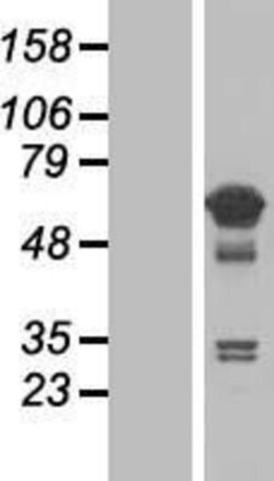 Novus Biologicals&trade;&nbsp;TCP11L1 Overexpression Lysate