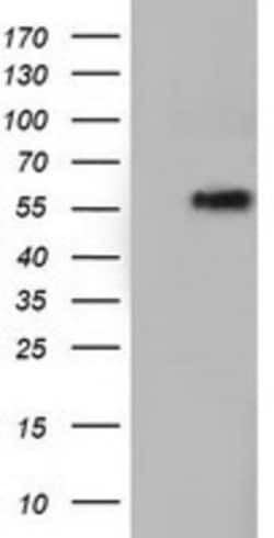 TCP11L2 Antibody (OTI2A10), Novus Biologicals 0.1mL; Unlabeled:Antibodies,