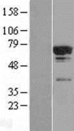 Novus Biologicals&trade;&nbsp;TCP11L2 Overexpression Lysate