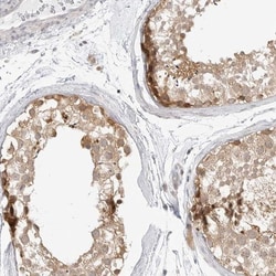 TCP1 alpha Antibody, Novus Biologicals:Antibodies:Primary Antibodies