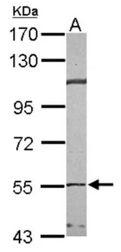 anti-TCP1-beta, Polyclonal, Novus Biologicals 0.1mL; Unlabeled:Antibodies,