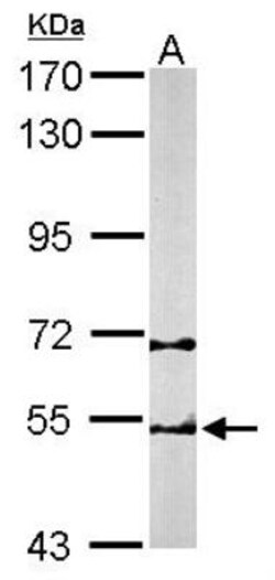 TCP1-beta Antibody, Novus Biologicals 0.1mg; Unlabeled:Antibodies, Polyclonal