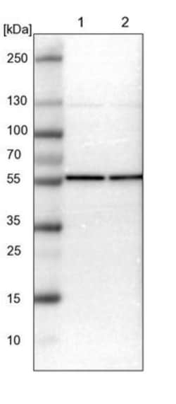 TCP1-beta Antibody, Novus Biologicals:Antibodies:Primary Antibodies