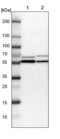 TCP1-beta Antibody, Novus Biologicals:Antibodies:Primary Antibodies