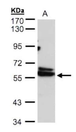 TCP1-delta Antibody, Novus Biologicals 0.1mL; Unlabeled:Antibodies, Polyclonal