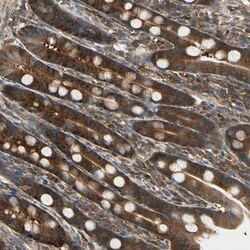 TCP1-eta Antibody, Novus Biologicals 25 &mu;L; Unlabeled:Antibodies, Polyclonal