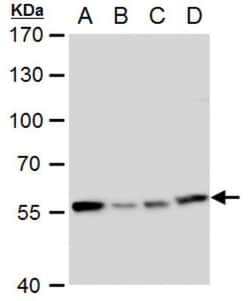 TCP1-eta Antibody, Novus Biologicals 0.1mL; Unlabeled:Antibodies, Polyclonal