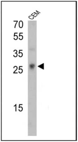 TCR gamma/delta Antibody (7A5), Novus Biologicals 200 &mu;g; Unconjugated:Antibodies,