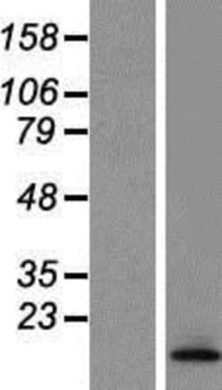 Novus Biologicals&trade;&nbsp;TCTA Overexpression Lysate