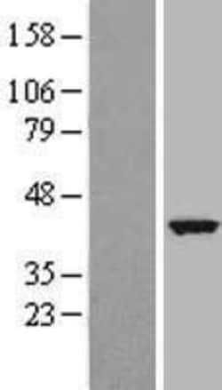 Novus Biologicals&trade;&nbsp;TCTE3 Overexpression Lysate
