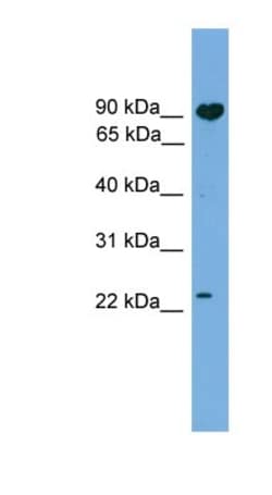 TCTEX1D4 Antibody, Novus Biologicals 100&mu;L; Unlabeled:Antibodies, Polyclonal
