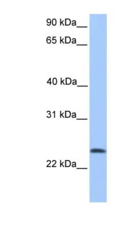 TCTEX1D4 Antibody, Novus Biologicals 20&mu;L; Unlabeled:Antibodies, Polyclonal