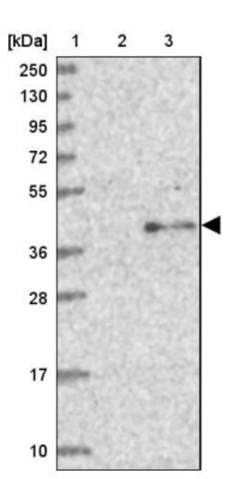 TCTN1 Antibody, Novus Biologicals 0.1mL; Unlabeled:Antibodies, Polyclonal