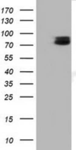 TCTN2 Antibody (OTI1C1), Novus Biologicals 0.1mL; Unlabeled:Antibodies,