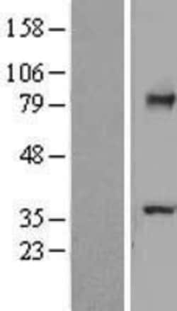 Novus Biologicals™ TCTN2 Overexpression Lysate