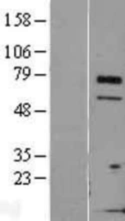 Novus Biologicals&trade;&nbsp;TCTN3 Overexpression Lysate