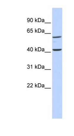 TCTN3 Antibody, Novus Biologicals:Antibodies:Primary Antibodies