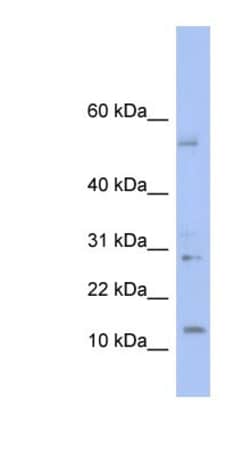 TDI Antibody, Novus Biologicals 100&mu;L; Unlabeled:Antibodies, Polyclonal
