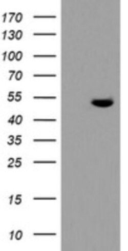 TDO2 Antibody (OTI2A4), Novus Biologicals 0.1mL; Unlabeled:Antibodies,