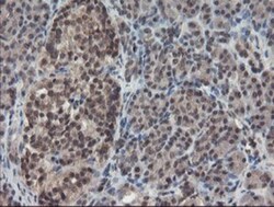 TDO2 Antibody (OTI2A4), Novus Biologicals 0.1mL; Unlabeled:Antibodies,