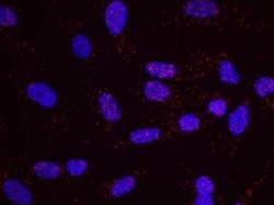 TDP1 Antibody, Novus Biologicals 0.1mL; Unlabeled:Antibodies, Polyclonal