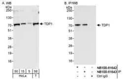 TDP1 Antibody, Novus Biologicals 0.1mL; Unlabeled:Antibodies, Polyclonal
