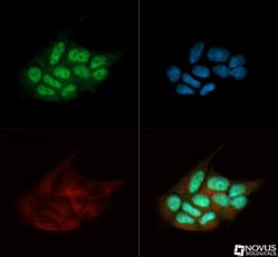 TDP-43/TARDBP Antibody - BSA Free, Novus Biologicals 0.025mL; Unlabeled:Antibodies,