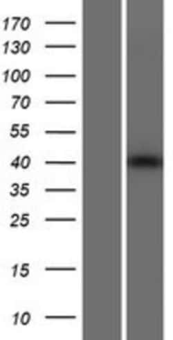 Novus Biologicals&trade;&nbsp;TDRD10 Overexpression Lysate