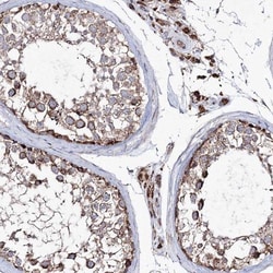 TDRD1 Antibody, Novus Biologicals:Antibodies:Primary Antibodies