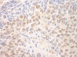 TDRD3 Antibody, Novus Biologicals 0.1mg; Unlabeled:Antibodies, Polyclonal