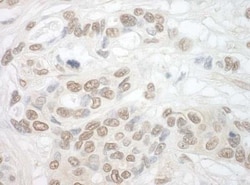 TDRD3 Antibody, Novus Biologicals 0.1mg; Unlabeled:Antibodies, Polyclonal