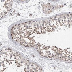TDRD7 Antibody, Novus Biologicals:Antibodies:Primary Antibodies