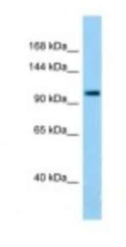 TDRD7 Antibody, Novus Biologicals 100&mu;L; Unlabeled:Antibodies, Polyclonal