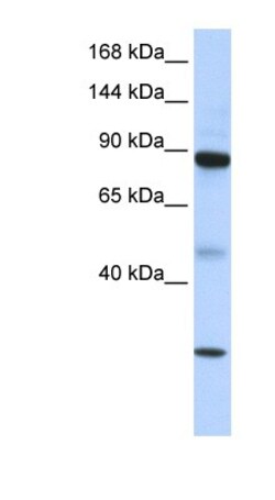TDRD9 Antibody, Novus Biologicals 100&mu;L; Unlabeled:Antibodies, Polyclonal