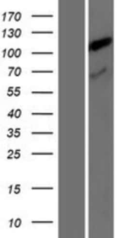 Novus Biologicals&trade;&nbsp;TDRKH Overexpression Lysate