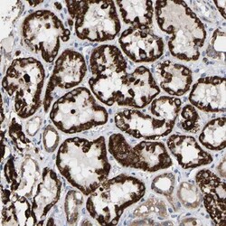 TDRKH Antibody, Novus Biologicals 0.1mL; Unlabeled:Antibodies, Polyclonal