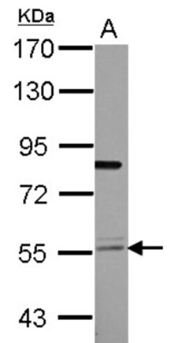 TEAD4 Antibody, Novus Biologicals 0.1mL; Unlabeled:Antibodies, Polyclonal