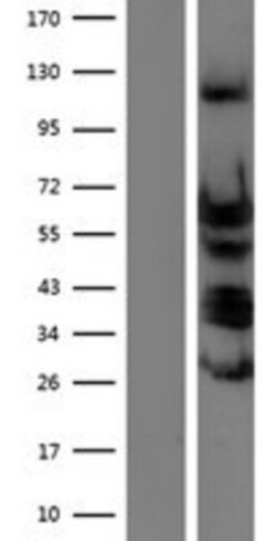 Novus Biologicals&trade;&nbsp;TEAD4 Overexpression Lysate