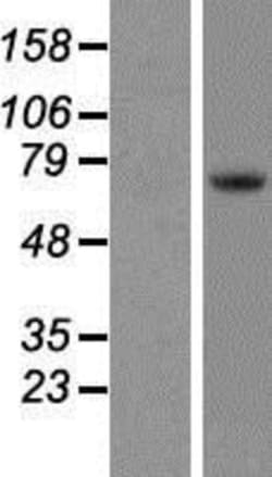 Novus Biologicals&trade;&nbsp;Tec Overexpression Lysate