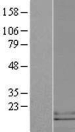 Novus Biologicals&trade;&nbsp;CCL25/TECK Overexpression Lysate