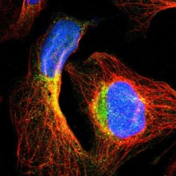 TECPR2 Antibody, Novus Biologicals 0.1mL; Unlabeled:Antibodies, Polyclonal