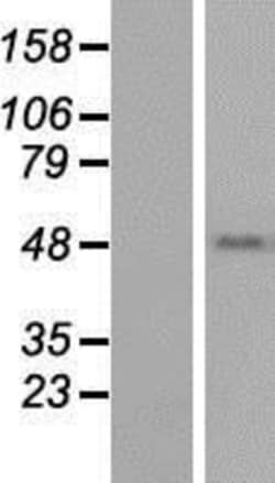 Novus Biologicals&trade;&nbsp;TEKT1 Overexpression Lysate
