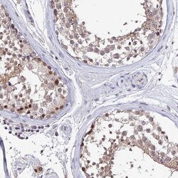 TEKT1 Antibody, Novus Biologicals:Antibodies:Primary Antibodies