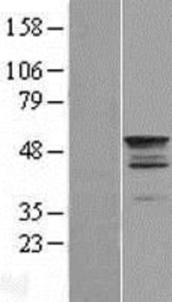 Novus Biologicals&trade;&nbsp;TEKT2 Overexpression Lysate