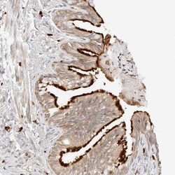 TEKT2 Antibody, Novus Biologicals 25 &mu;L; Unlabeled:Antibodies, Polyclonal