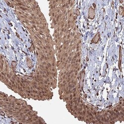 TEL2 Antibody, Novus Biologicals 25 &mu;L; Unlabeled:Antibodies, Polyclonal