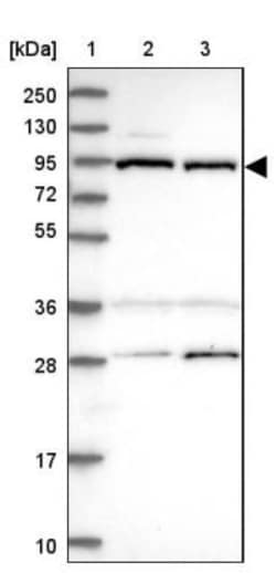 TEL2 Antibody, Novus Biologicals 25 &mu;L; Unlabeled:Antibodies, Polyclonal